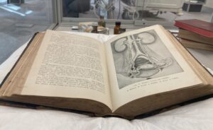 old medical book displaying page with image of urinary system anatomy